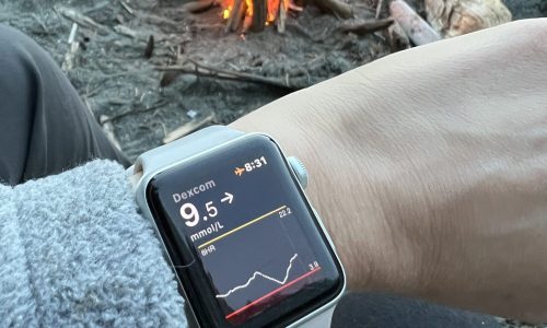 dexcom-reading_apple-watch_bg-check_campfire_vertical-photo_west-coast-trail